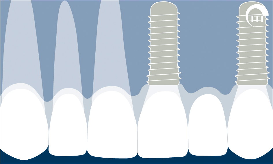 Vol6_Chapter3.5_Fig15c